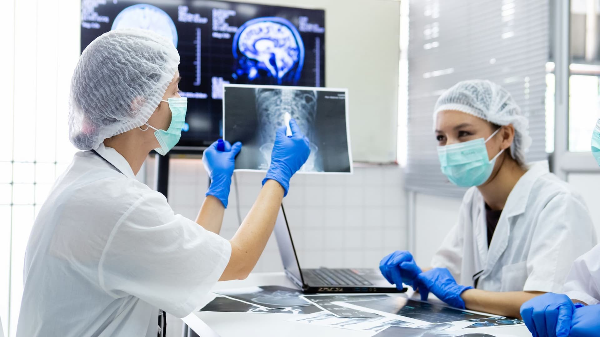 NLP Concept Illustration